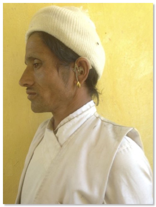 Hearing aid, traditional healer, Bajhang, 2013